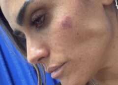 Exigen castigo a responsables tras ataque a Alessandra Rojo de la Vega